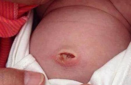 照顾新生婴儿，这几个地方不能随便动！